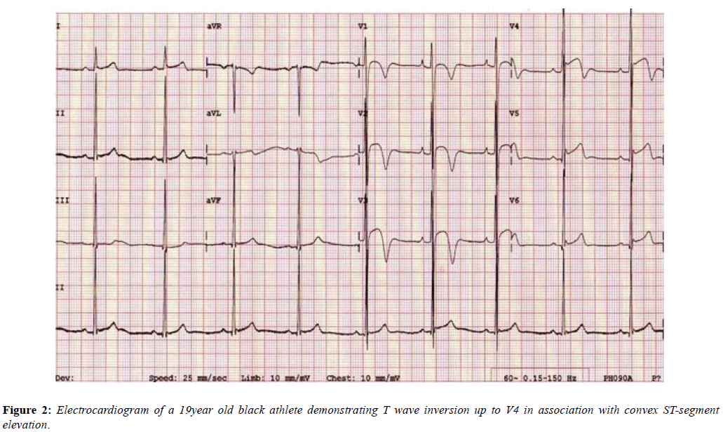 current-trends-cardiology-segment-elevation