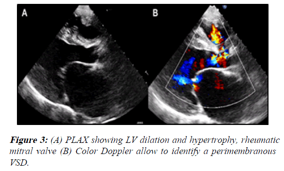 current-trends-in-cardiology-Doppler