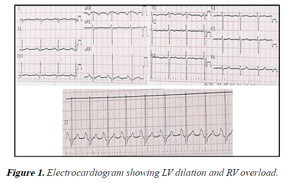 current-trends-in-cardiology-Electrocardiogram