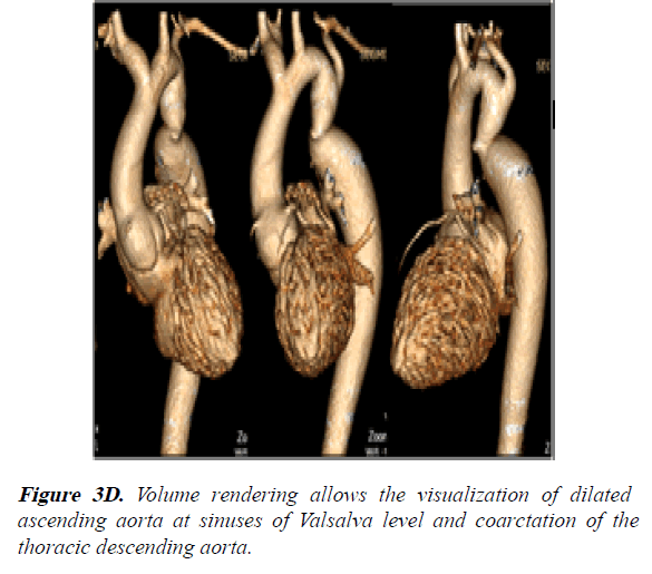 current-trends-in-cardiology-Volume