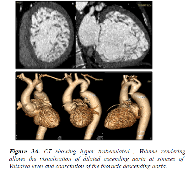 current-trends-in-cardiology-aorta