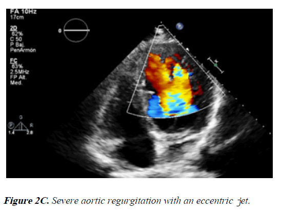 current-trends-in-cardiology-eccentric