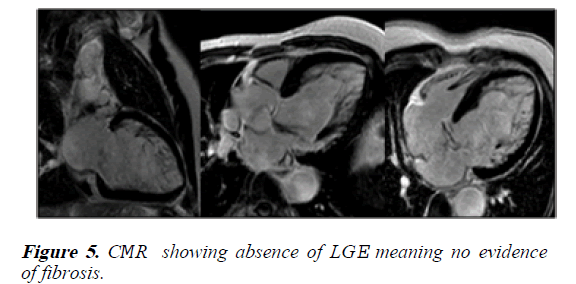 current-trends-in-cardiology-meaning