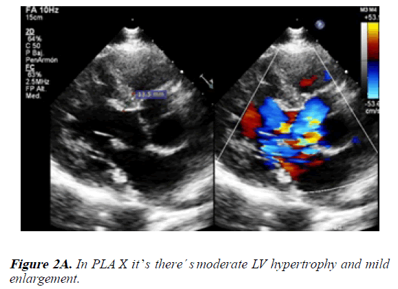 current-trends-in-cardiology-moderate