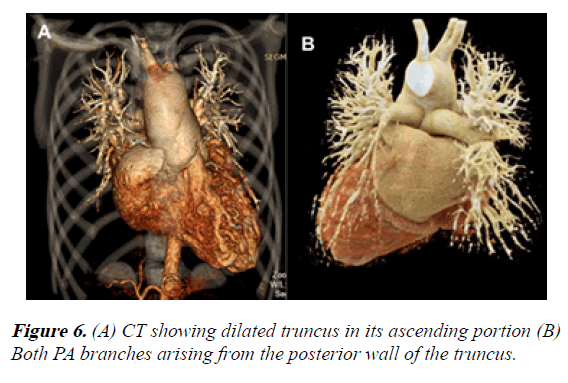 current-trends-in-cardiology-portion