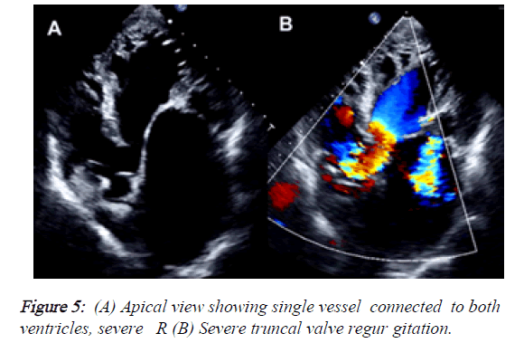 current-trends-in-cardiology-single