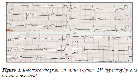 current-trends-in-cardiology-sinus