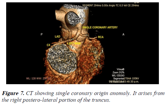 current-trends-in-cardiology-truncus