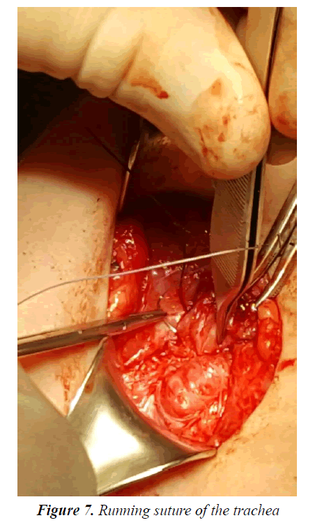 currentpediatrics-Running-suture