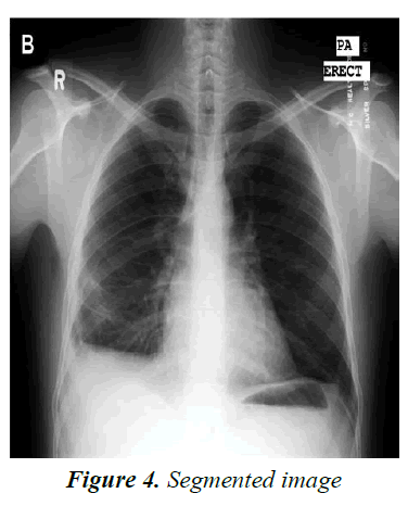 currentpediatrics-Segmented-image