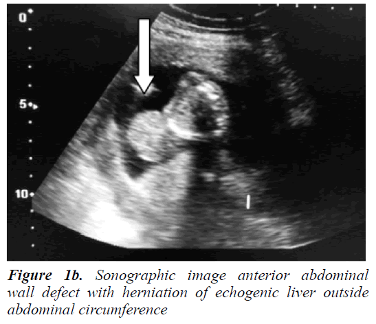 currentpediatrics-anterior-abdominal