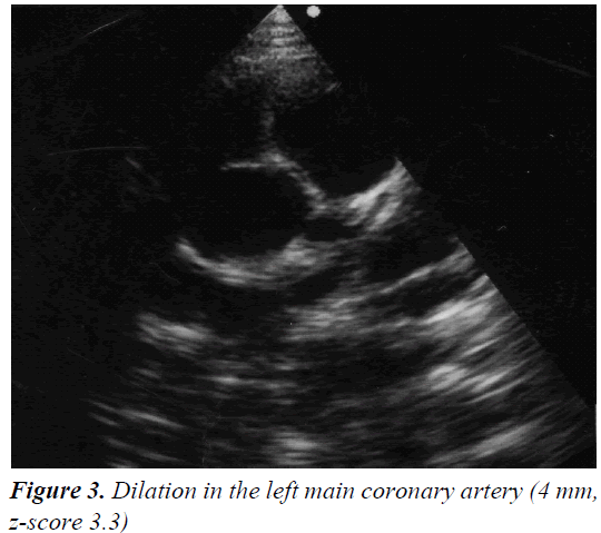 currentpediatrics-coronary-artery