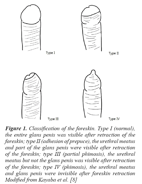 currentpediatrics-entire-glans-penis