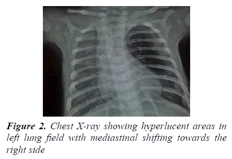 currentpediatrics-hyperlucent-areas