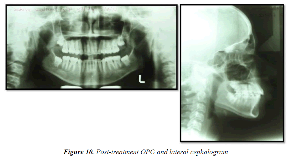 currentpediatrics-lateral-cephalogram