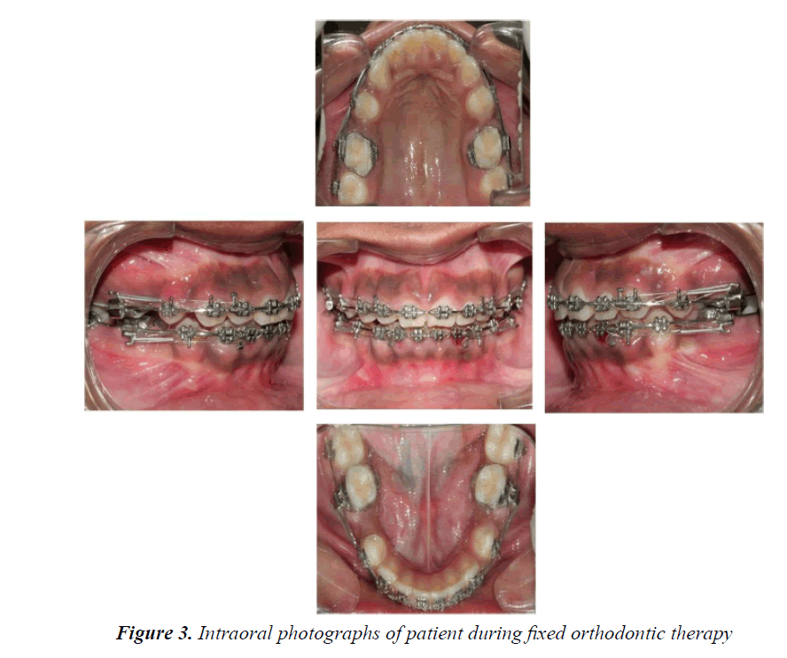 currentpediatrics-orthodontic-therapy