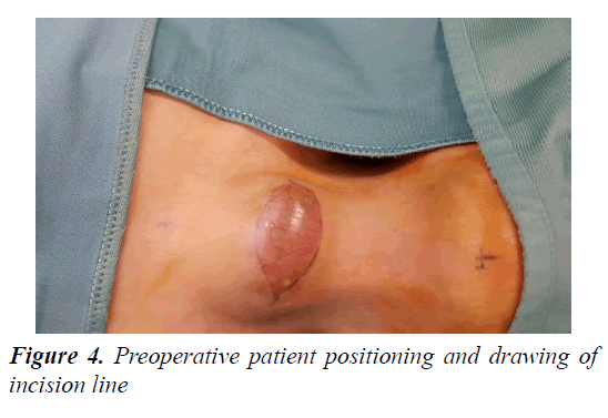 currentpediatrics-patient-positioning