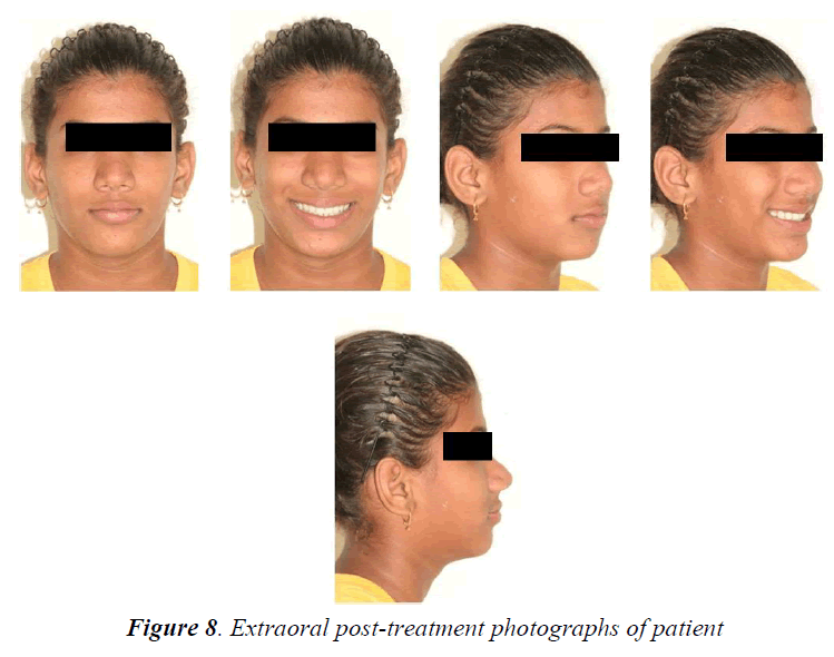 currentpediatrics-post-treatment