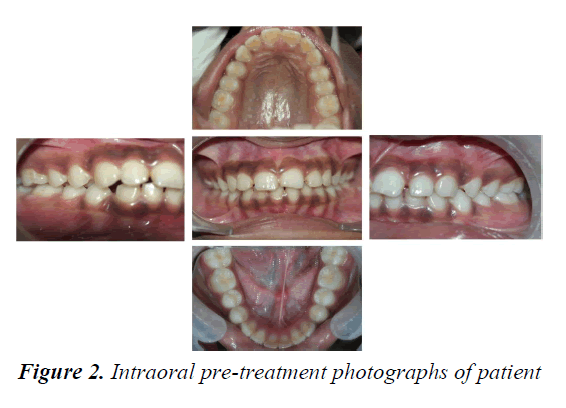 currentpediatrics-pre-treatment