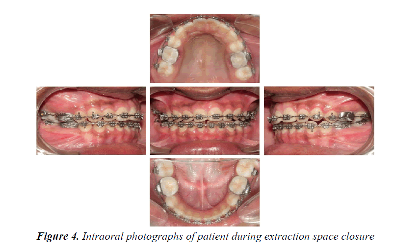 currentpediatrics-space-closure