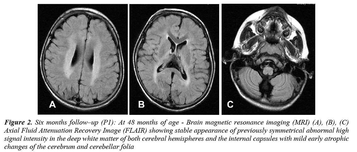 currentpediatrics-symmetrical-abnormal