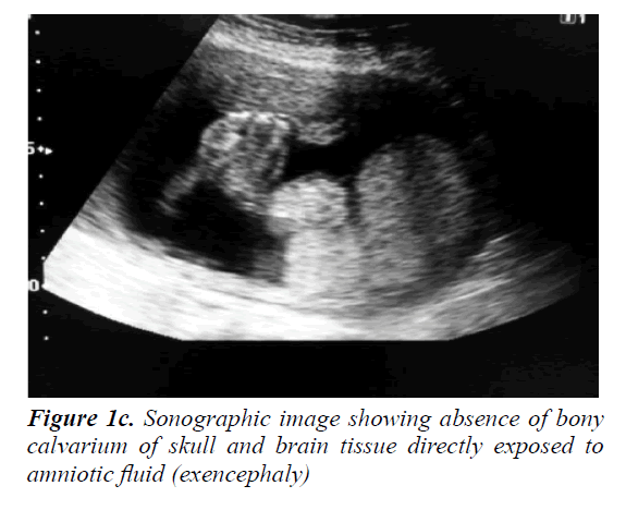 currentpediatrics-tissue-directly