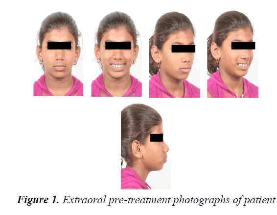 currentpediatrics-treatment-photographs