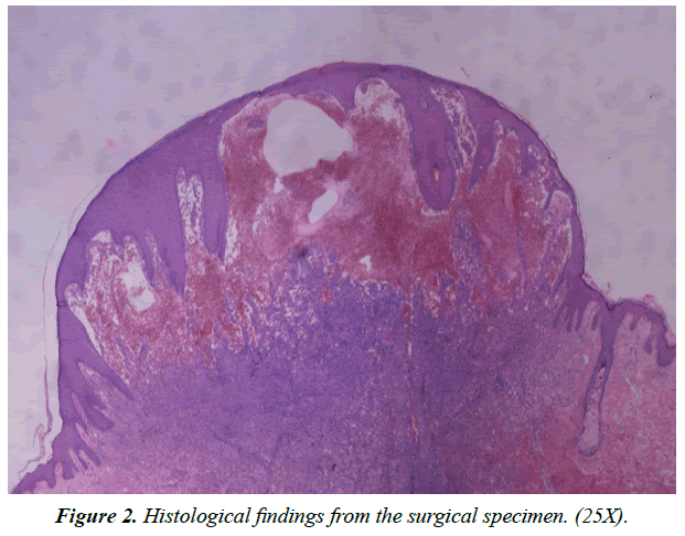 dermatology-research-skin-care-Histological-findings