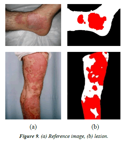 dermatology-research-skin-care-Reference-image