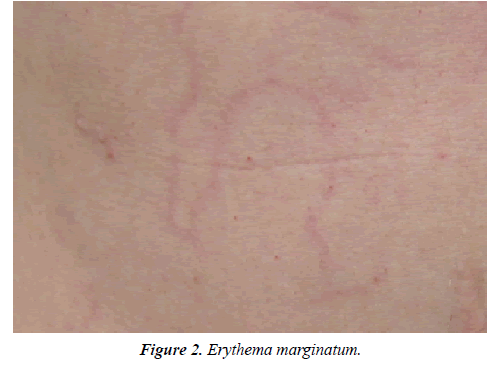 dermatology-research-skin-care-erythema