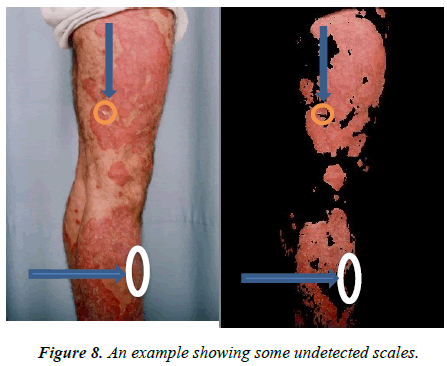 dermatology-research-skin-care-undetected-scales