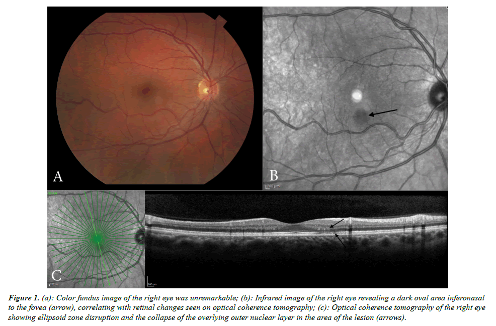 eye-research-fundus