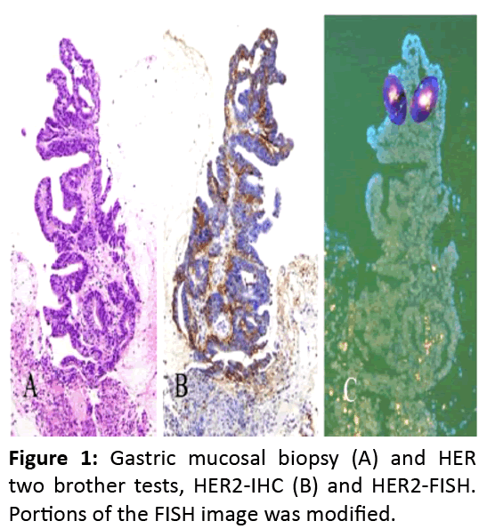 gastroenterology-and-digestive-diseases-Gastric-mucosal-biopsy