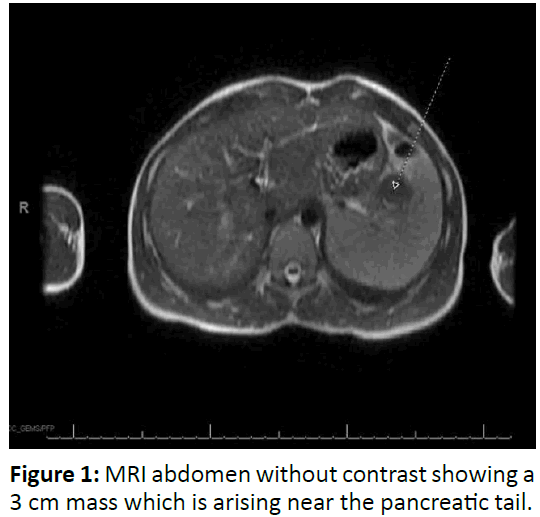 gastroenterology-and-digestive-diseases-MRI-abdomen-contrast
