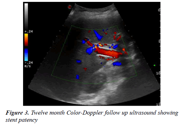 gastroenterology-and-digestive-diseases-ultrasound-showing-stent-patency