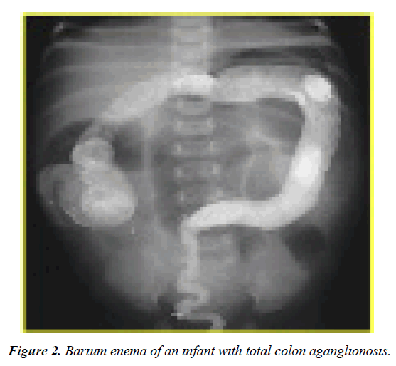gastroenterology-digestive-disease-Barium-enema