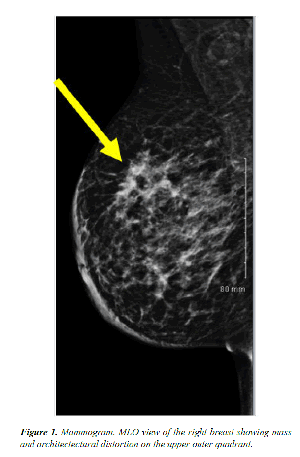 gastroenterology-digestive-disease-Mammogram