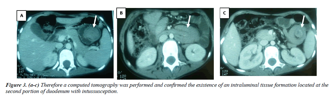 gastroenterology-digestive-disease-computed-tomography