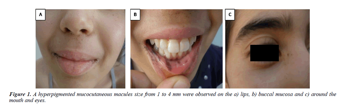 gastroenterology-digestive-disease-mucocutaneous-macules