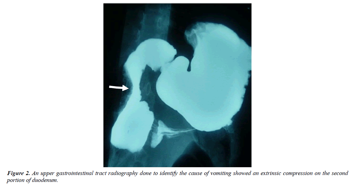 gastroenterology-digestive-disease-tract-radiography