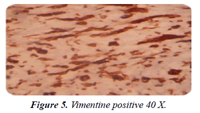 gastroenterology-digestive-diseases-Vimentine-positive