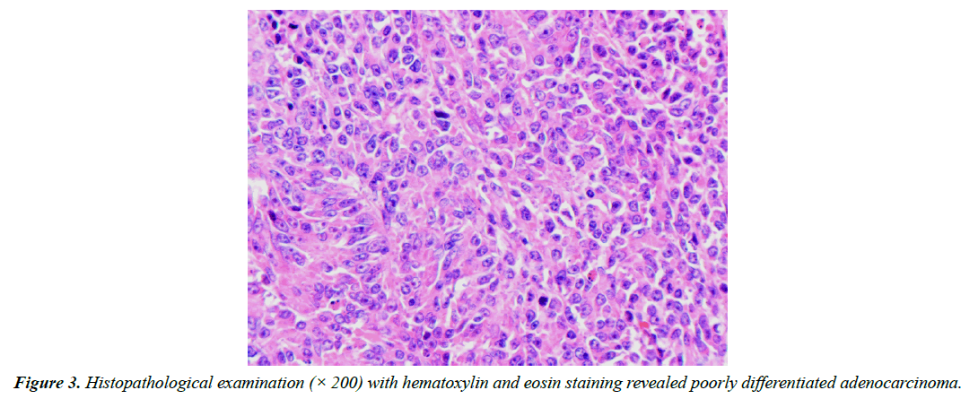 gastroenterology-digestive-diseases-eosin-staining