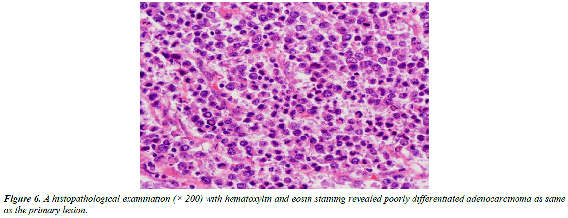 gastroenterology-digestive-diseases-hematoxylin