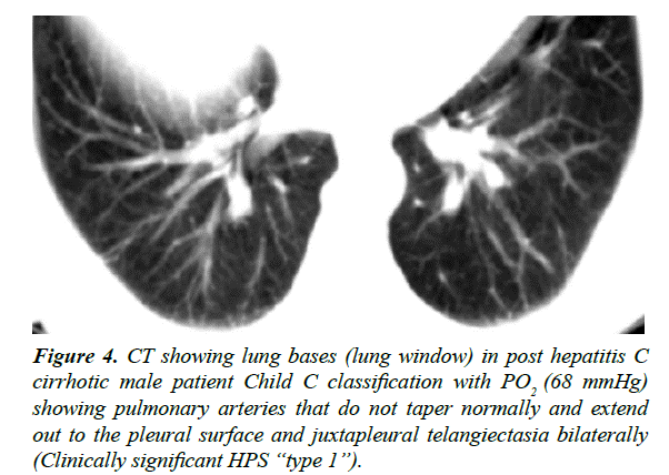 gastroenterology-digestive-diseases-juxtapleural