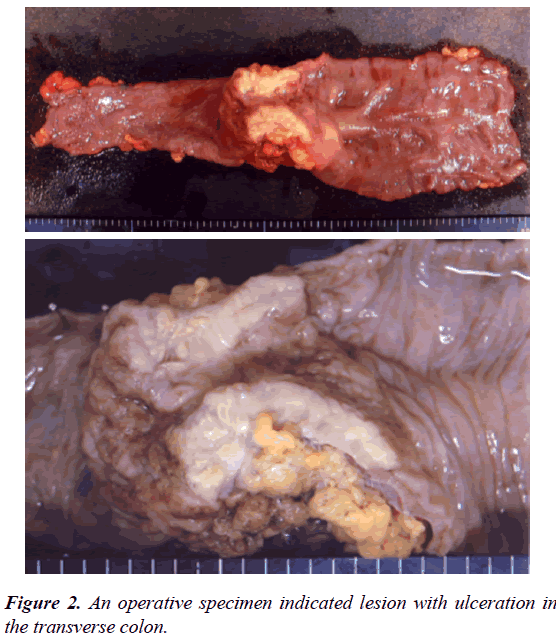 gastroenterology-digestive-diseases-operative-specimen