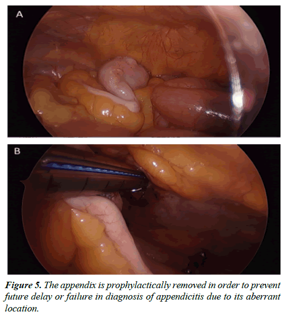 gastroenterology-digestive-diseases-prophylactically