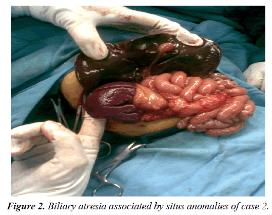 gastroenterology-digestive-diseases-situs-anomalies