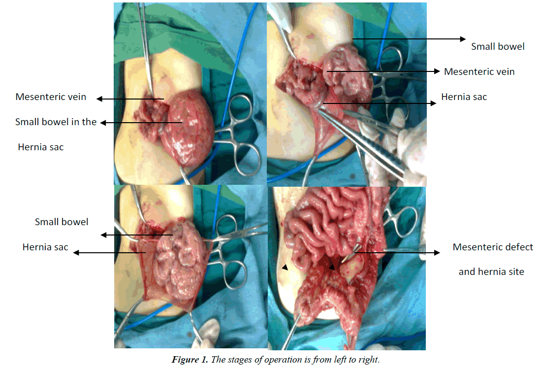 gastroenterology-digestive-diseases-stages-operation