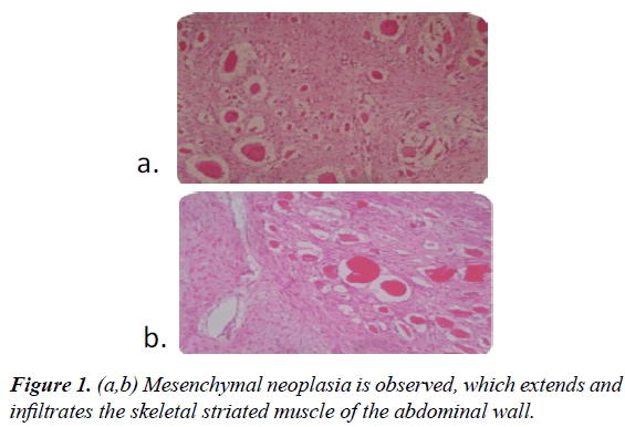 gastroenterology-digestive-diseases-striated-muscle