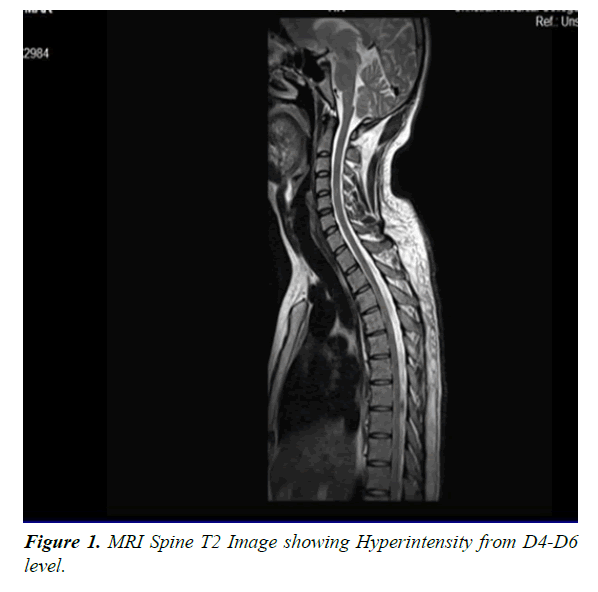 general-internal-medicine-MRI-Spine